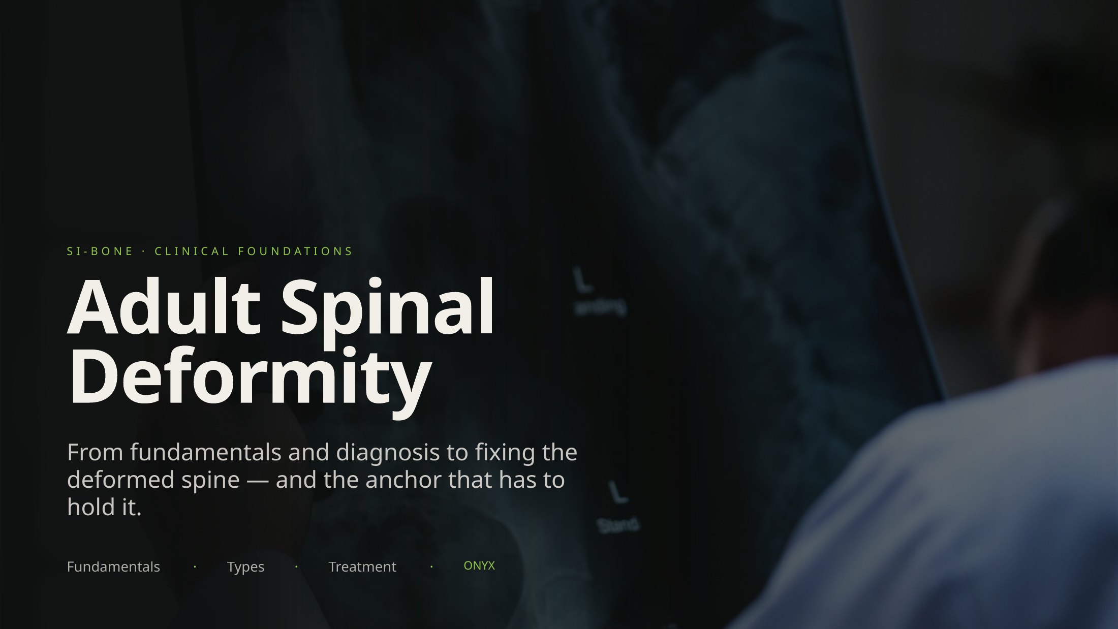 Title slide — Adult Spinal Deformity, SI-BONE clinical foundations